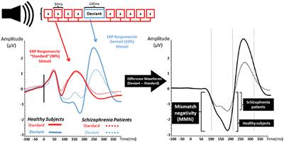 Using EEG-Guided Basket and Umbrella Trials in Psychiatry: A Precision Medicine Approach for Cognitive Impairment in Schizophrenia